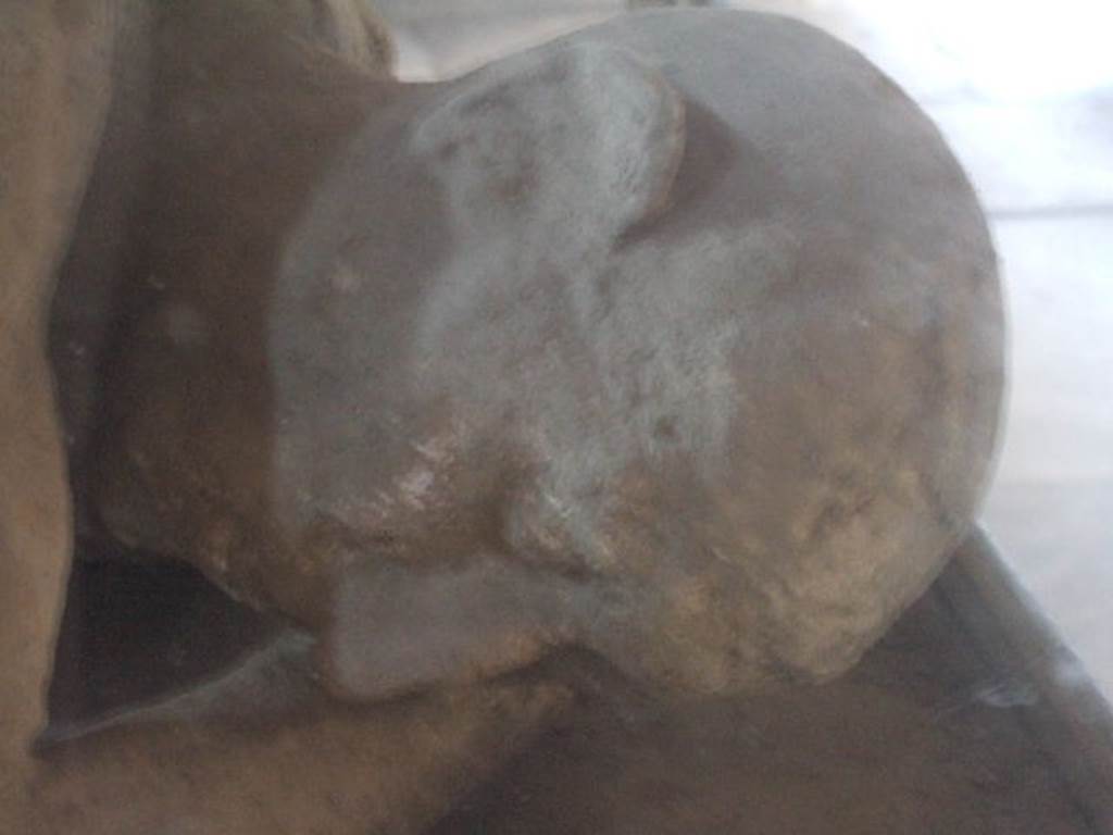 I.5.3 Pompeii. Detail of head of plaster cast known as The Sick Man.
In 1875 Fiorelli wrote: “……he lay down on the ground and there fell calmly into his eternal sleep”  Now on display in VII.1.8 The Stabian Baths, Men’s changing room.

